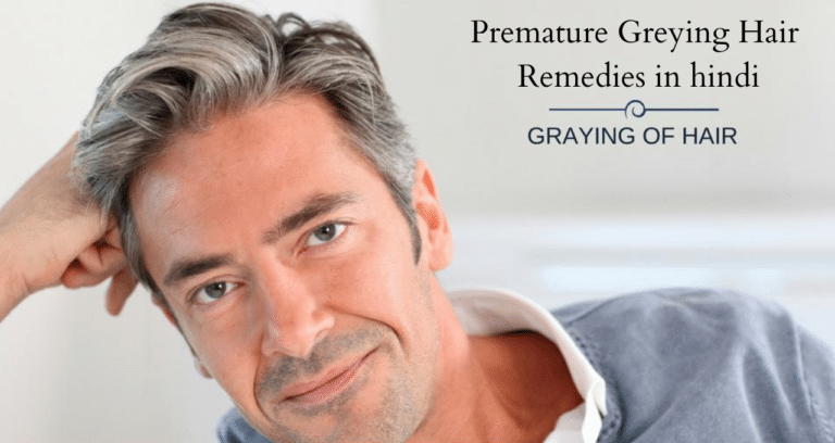 Premature Greying Hair Remedies in hindi
